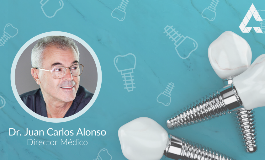Dr Juan Carlos Alonso Implantologia